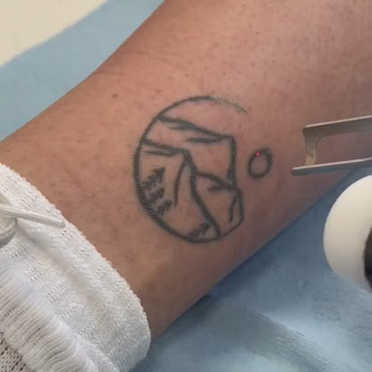NEATCELL— Fade Tattoos & Dark Spots at Home